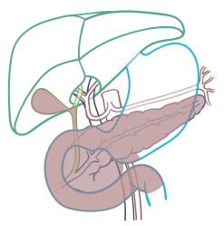 Extent of resection after complete removal of the pancreas